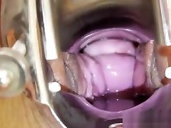 Chubby ghetto amature painful anal threesome gets a gyno