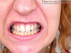 Mouth examination of Alex mouth