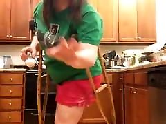 hip amputee