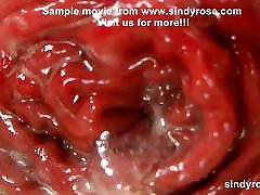 Sindy Rose in gold dress under 12 girl porn fist her ass and push prolapse