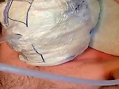 baby bois urine treatment