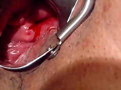 Show My Cervix And Speculum Vaginal In Menstrual Period
