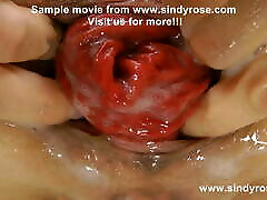 Sindy Rose in green shoes fisting her ass & anal prolapse