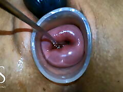 Maya Simons Masturbating her Cervix With a SPOON!