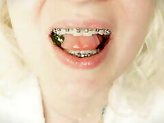 BRACES fetish: ASMR video of eating MUKBANG...