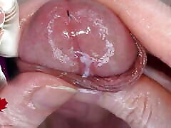 Super close-up of the glans. Urethral games with the dilator.